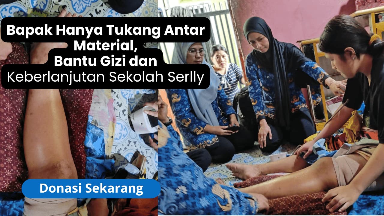 Patah Kaki Akibat Jatuh dari Tangga, Bantu Gizi dan Kelanjutan Sekolah Serlly